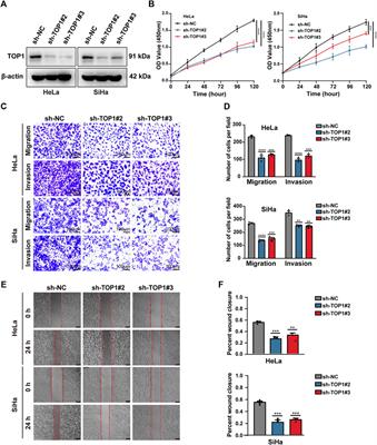 Oncoproteins E6 and E7 upregulate topoisomerase I to activate the cGAS-PD-L1 pathway in cervical cancer development